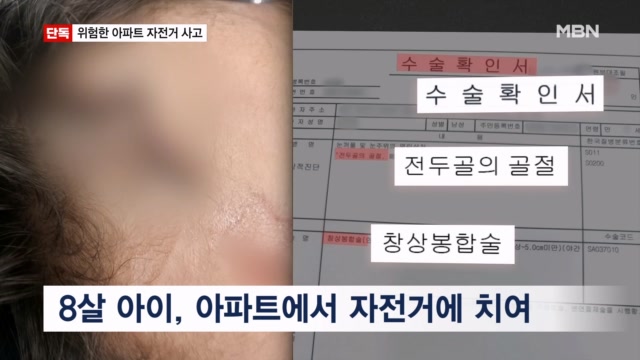 아파트 인도에서 8살 아이 치고 도망… 이마 60바늘 꿰맨 자전거 뺑소니
