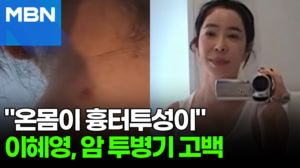 이혜영 "온몸에 상처와 흉터"…암 투병 후 근황 공개 [포크뉴스]