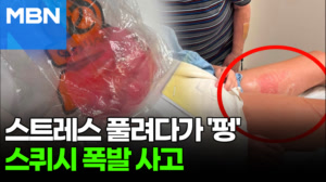 한여름 차 안에 '이 장난감' 두지 마세요…순식간에 폭발해 화상 [포크뉴스]