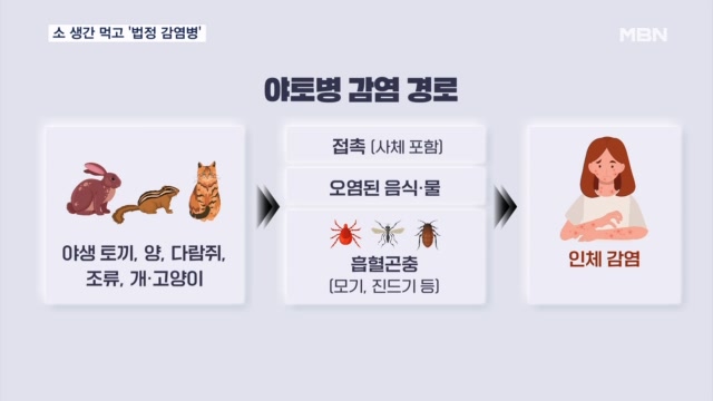 소 생간 먹고 복통·발열…치명률 60% '야토병' 의심 환자 발생