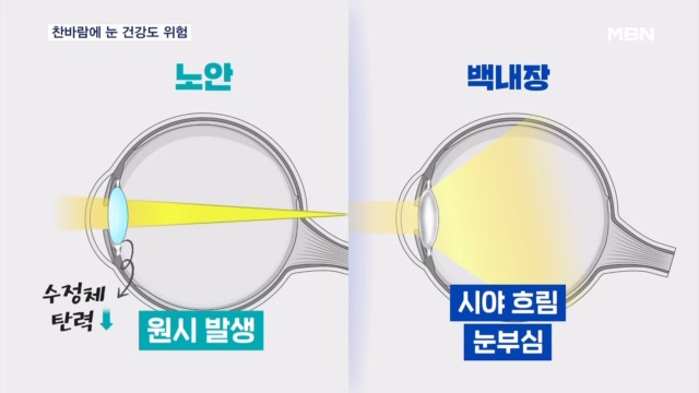뉴스 썸네일