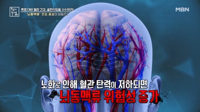 뇌 속 시한폭탄  뇌동맥류 의 전조 증상은?