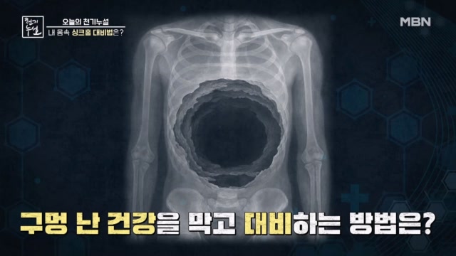 마른땅에 날벼락, 싱크홀! 내 몸속 싱크홀 대비법은?