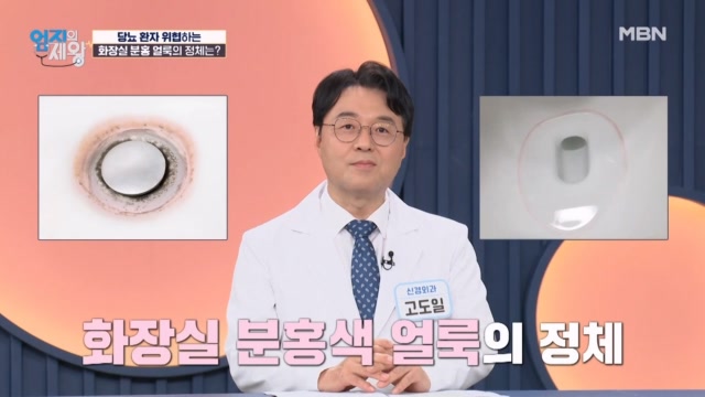 화장실에 있는 분홍색 얼룩이 당뇨 환자에게 위험한 이유는??