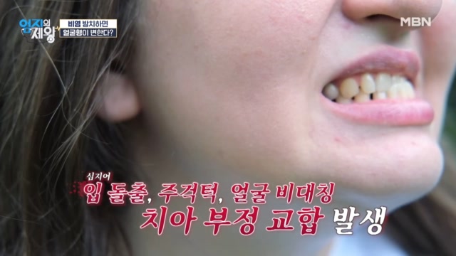 입 돌출, 얼굴 비대칭, 치아 부정 교합까지... 비염 방치하면 얼굴형이 변할 수 있다?!