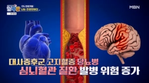 각종 합병증의 원인, 비만에서 벗어나라!