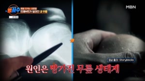 염증이 통증을 부른다