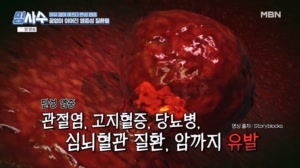 만병 부르는 질병의 씨앗