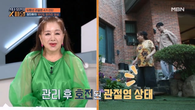 가수 장미화, 지팡이는 BYE BYE~~ 무릎 관절 보행법으로 180도 달라진 일상생활